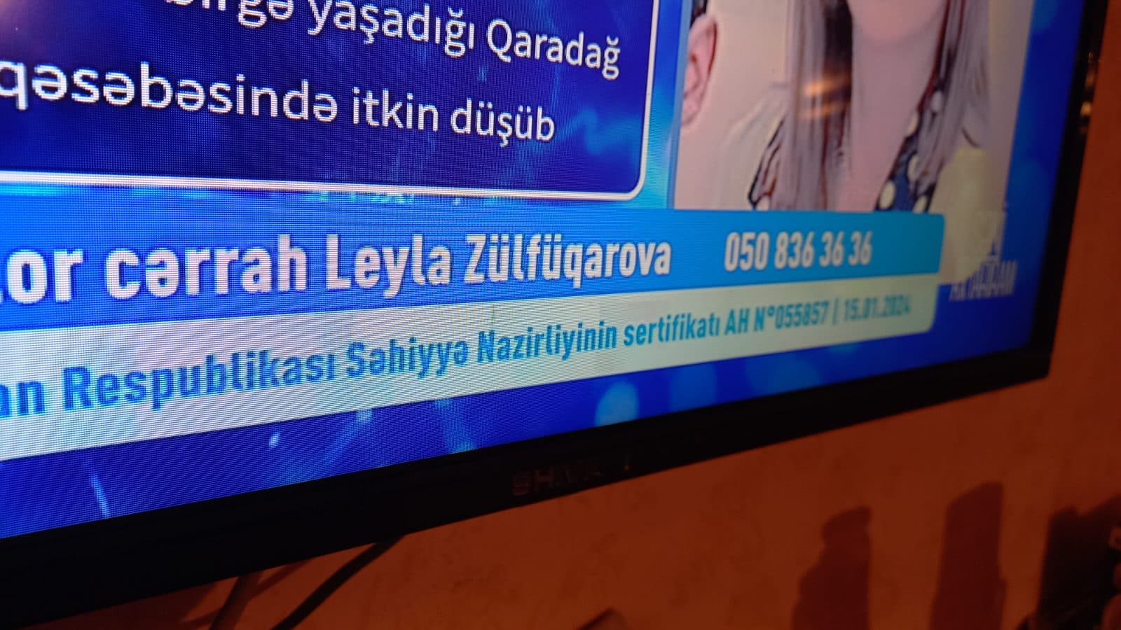 Barter mümkündü şəkil 2