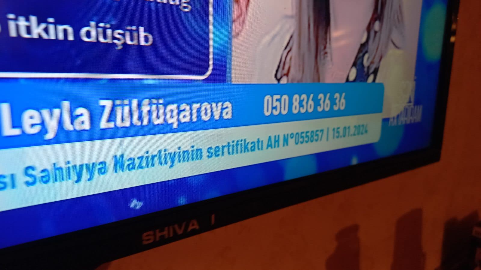 Barter mümkündü şəkil 3